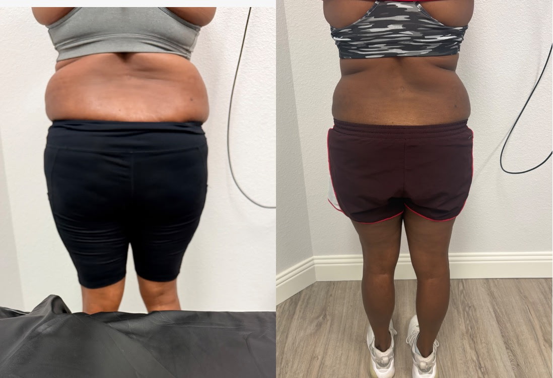 Client before and after result