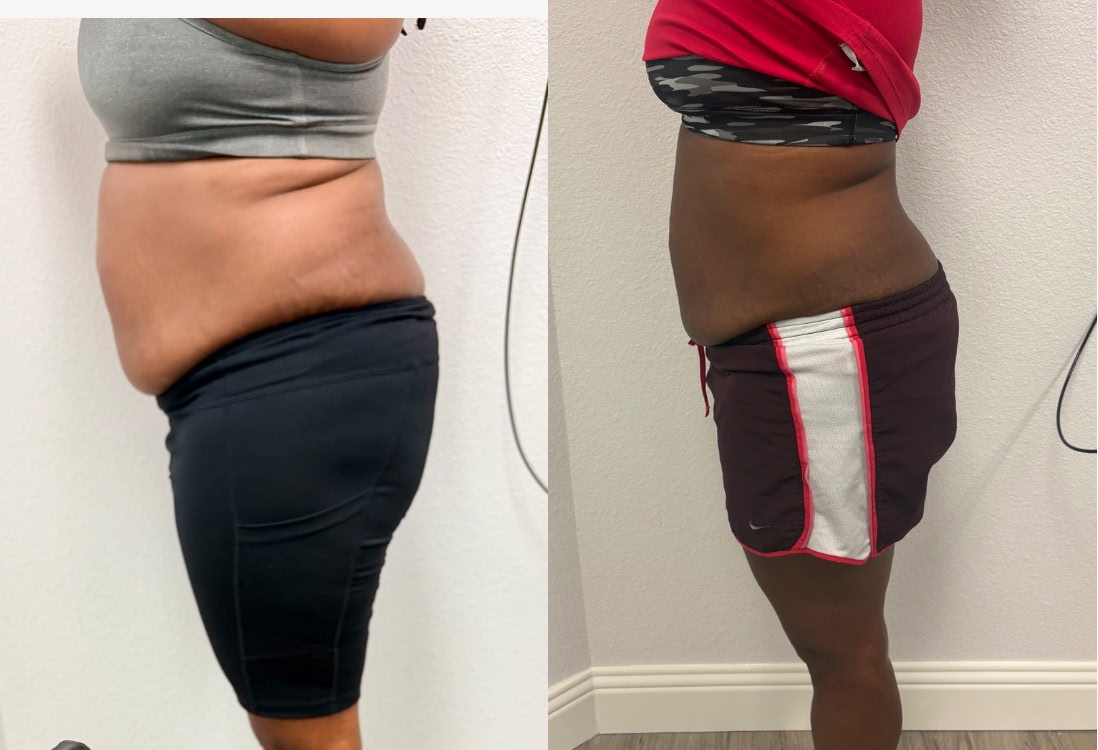 Client before and after result