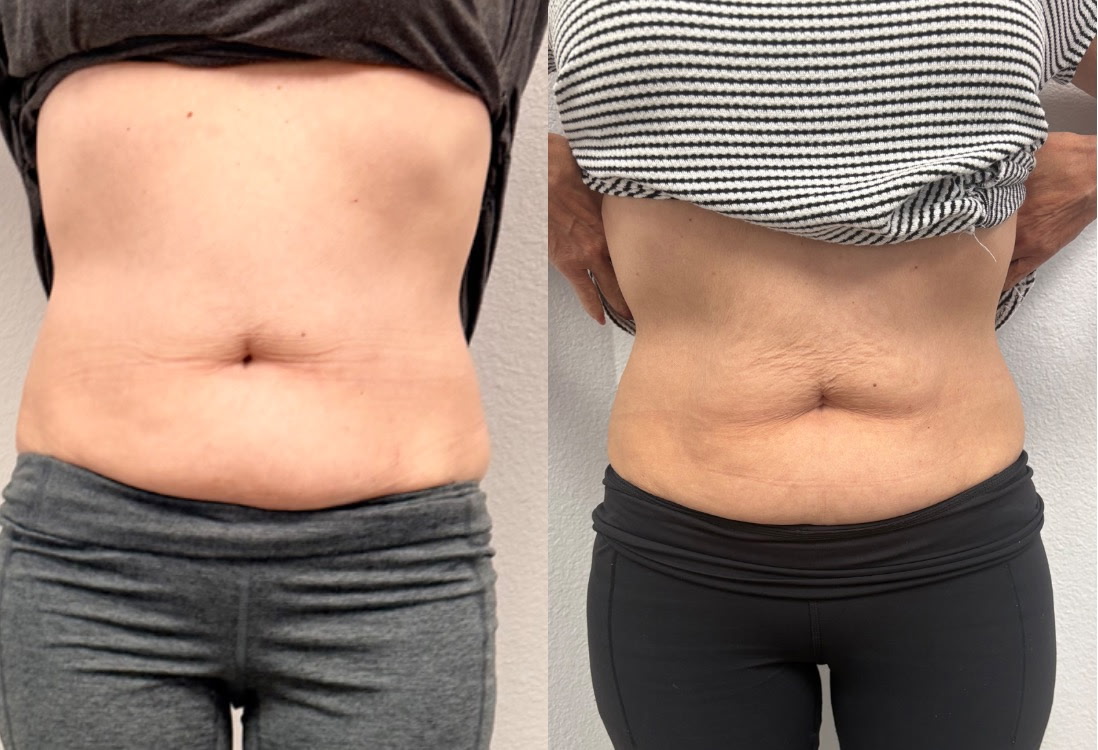 Client before and after result