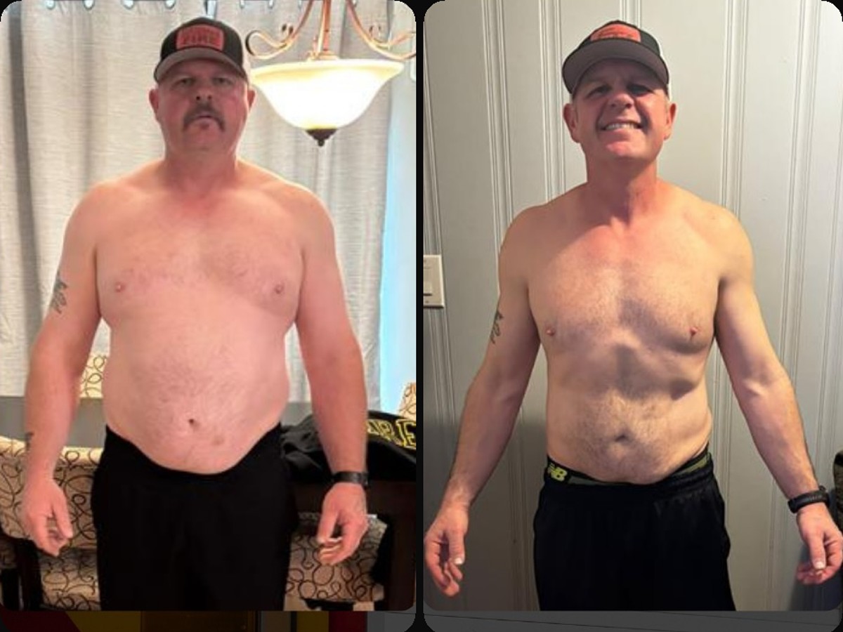 Trevor S, before and after