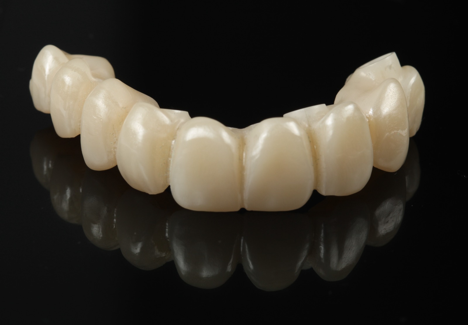 Prótesis dental fabricada en laboratorio propio, vista lateral