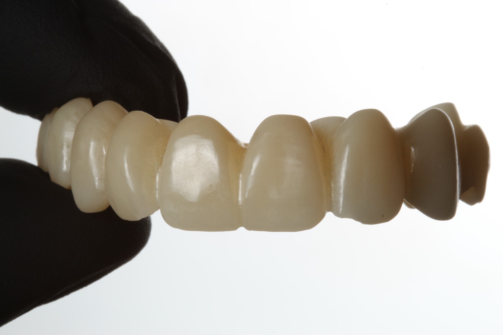 Prótesis dental terminada, vista frontal