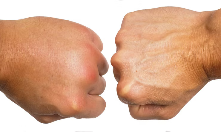 img img