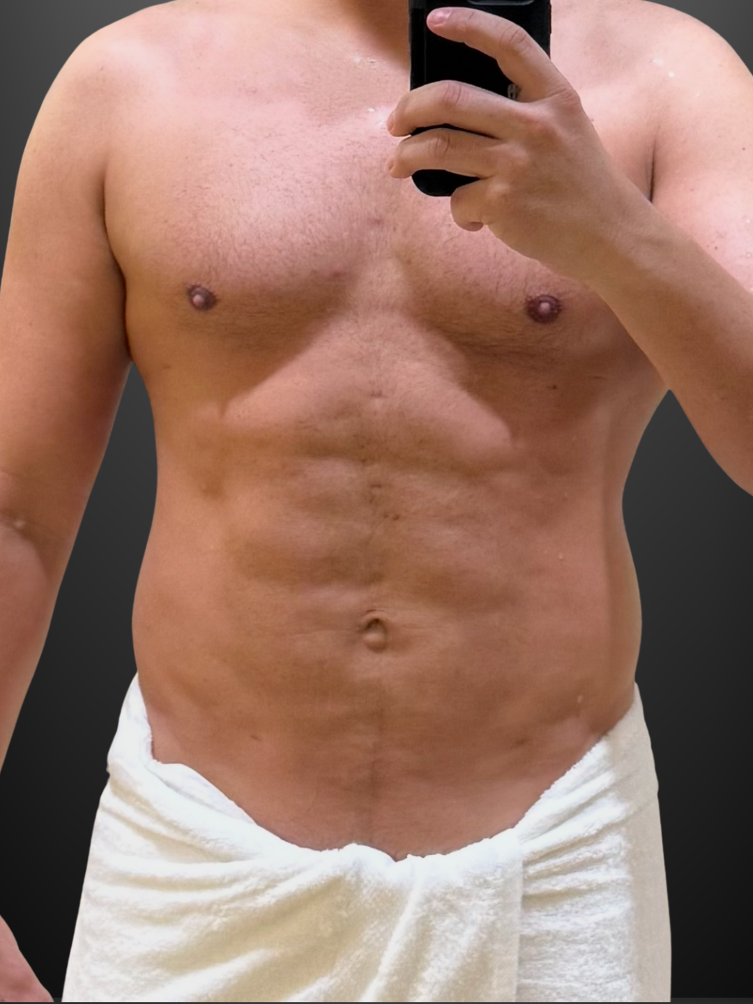 HD VASER Lipo + Chest — before