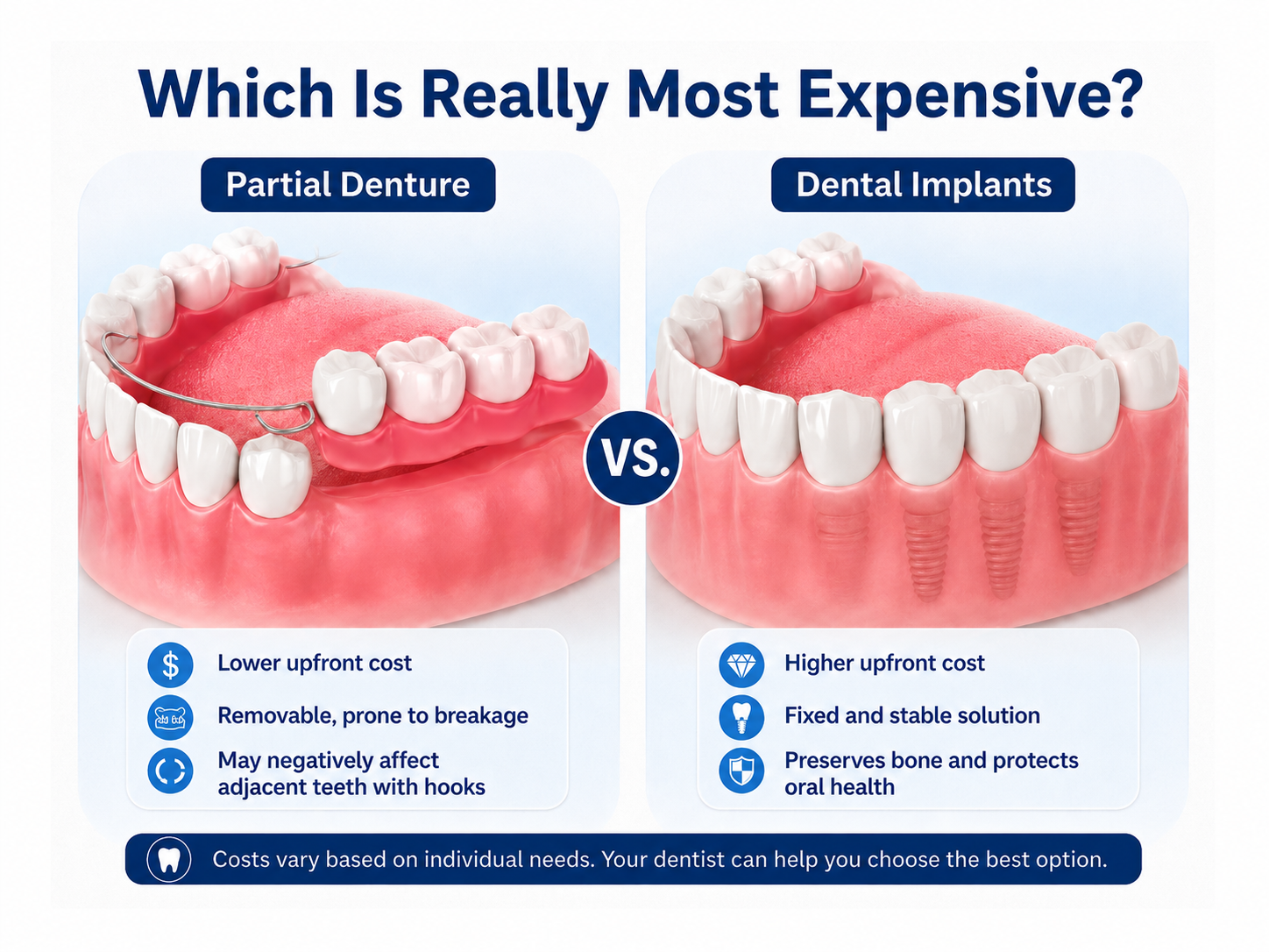 Are Removable Partial Dentures Cheaper Than Dental Implants?
