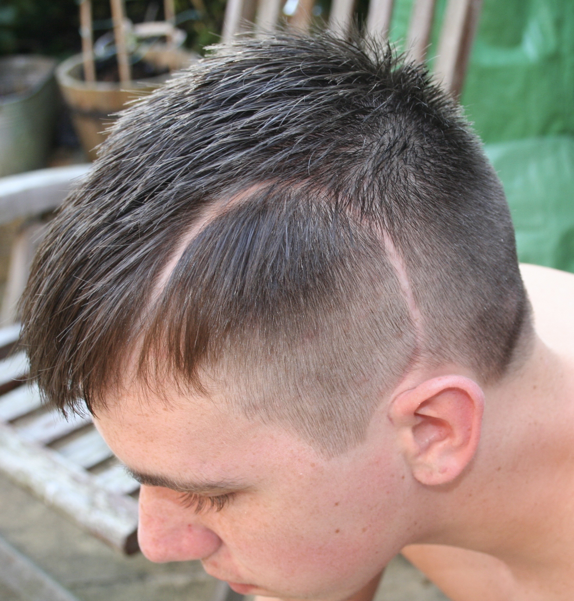 Ryan's scar