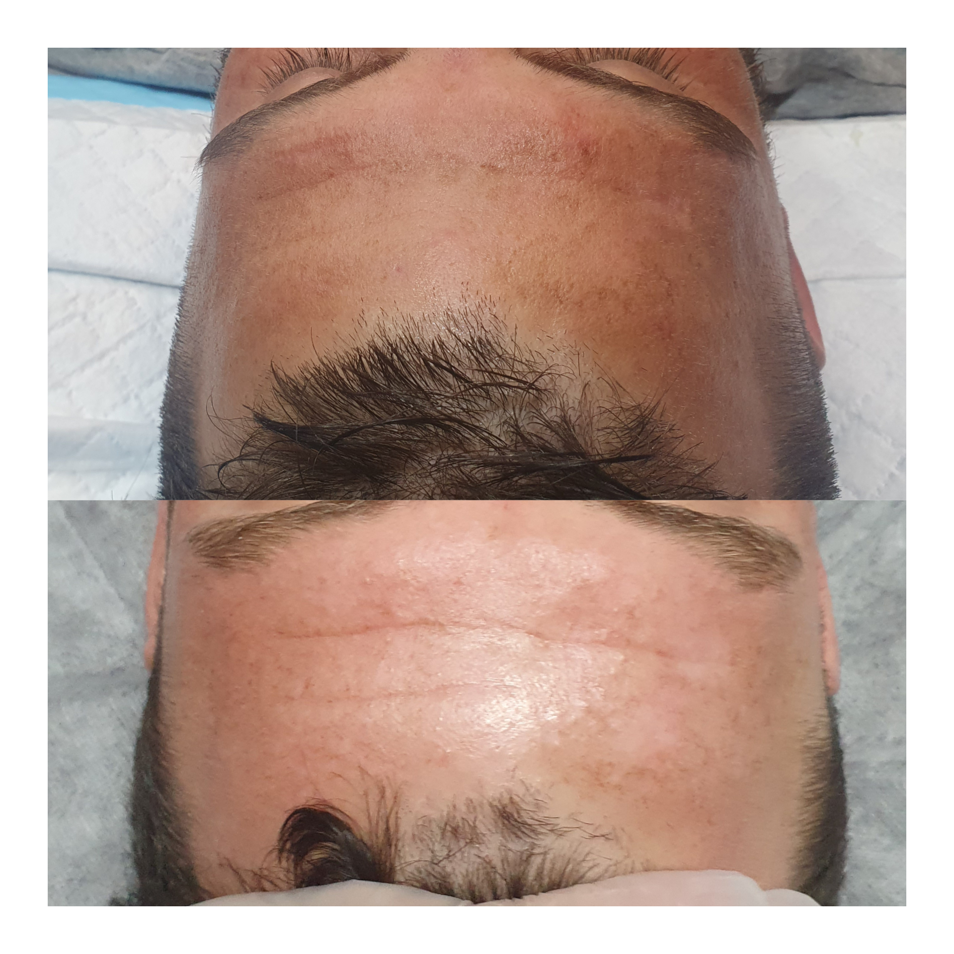 Pigment removal at Looks by Brooke