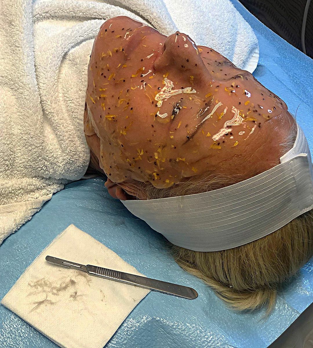 Dermablading with Hydro Jelly Mask at Looks by Brooke