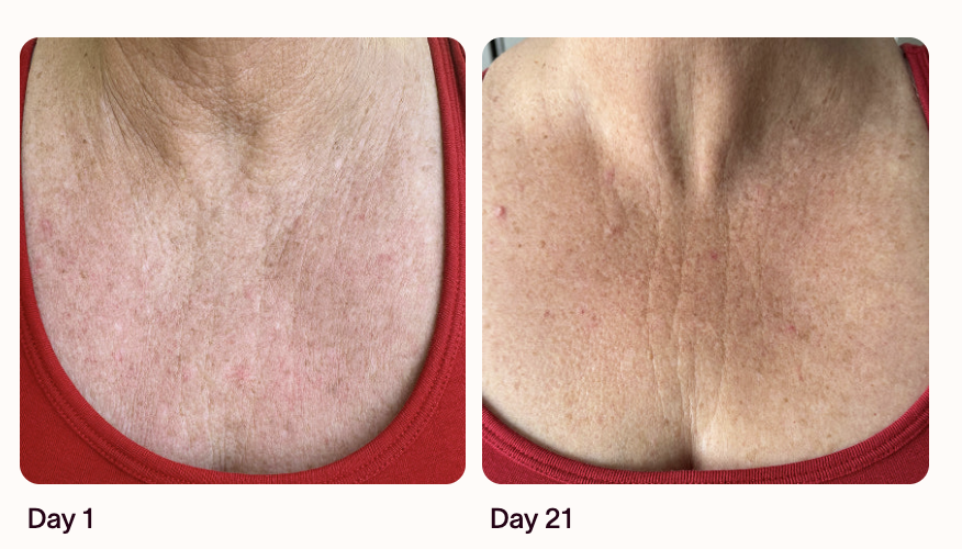 Smoother-looking skin result