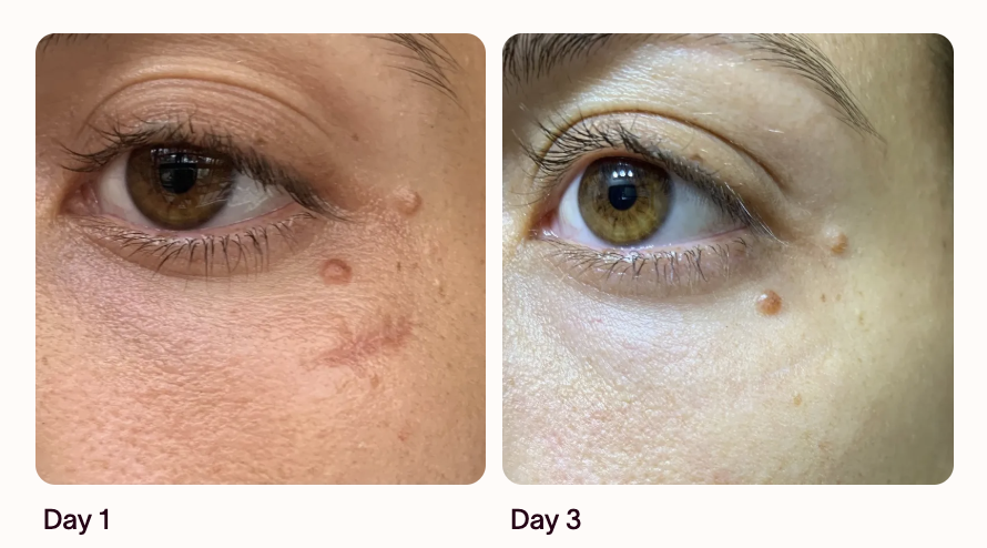 Brighter-looking skin result