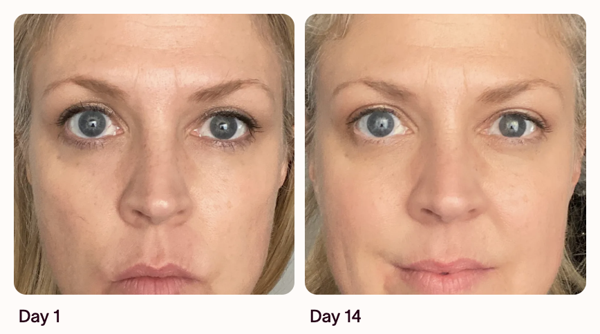 Firmer-looking skin result