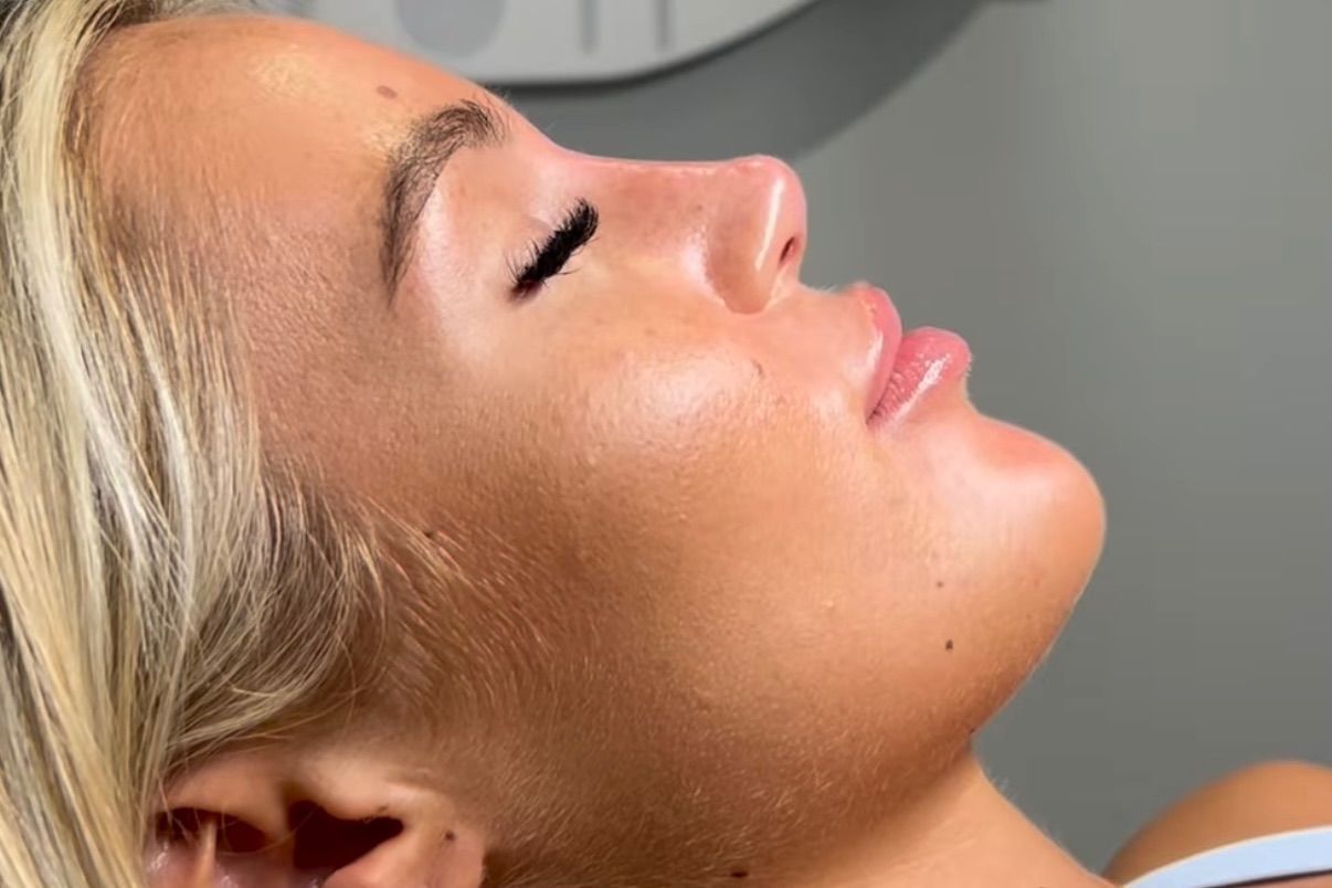 Cheek Contour