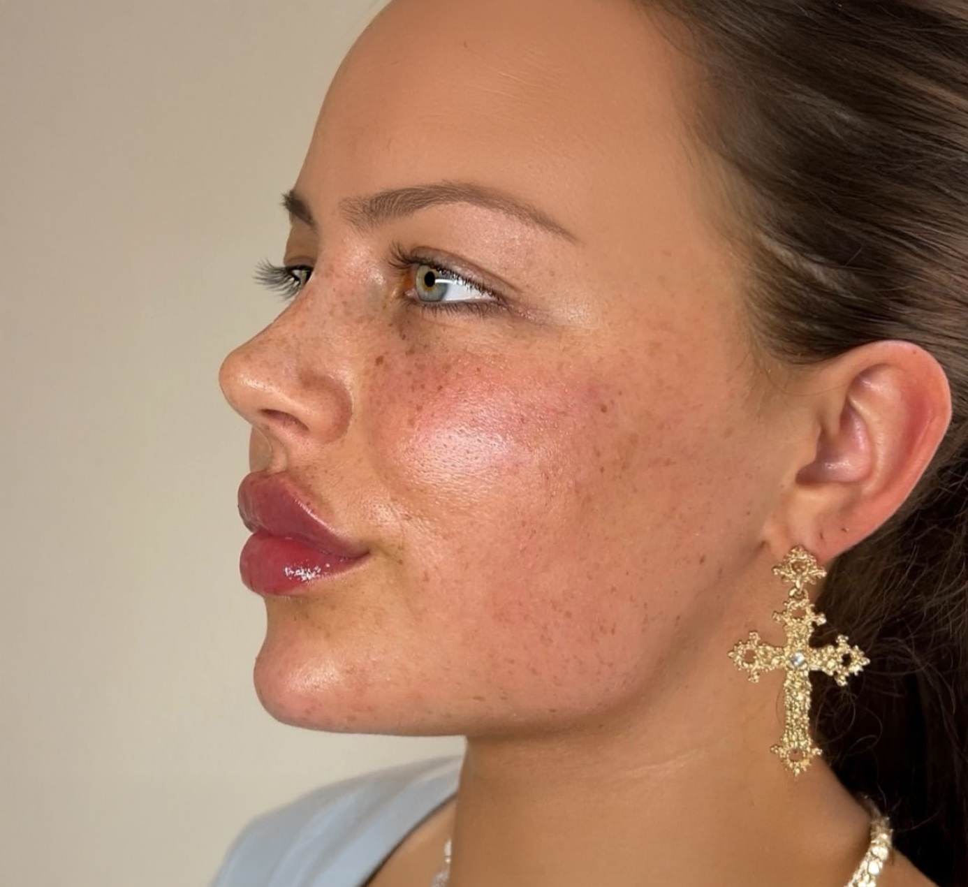 Jawline and Chin Contour