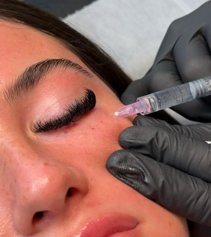Polynucleotides (Under Eye Treatment)