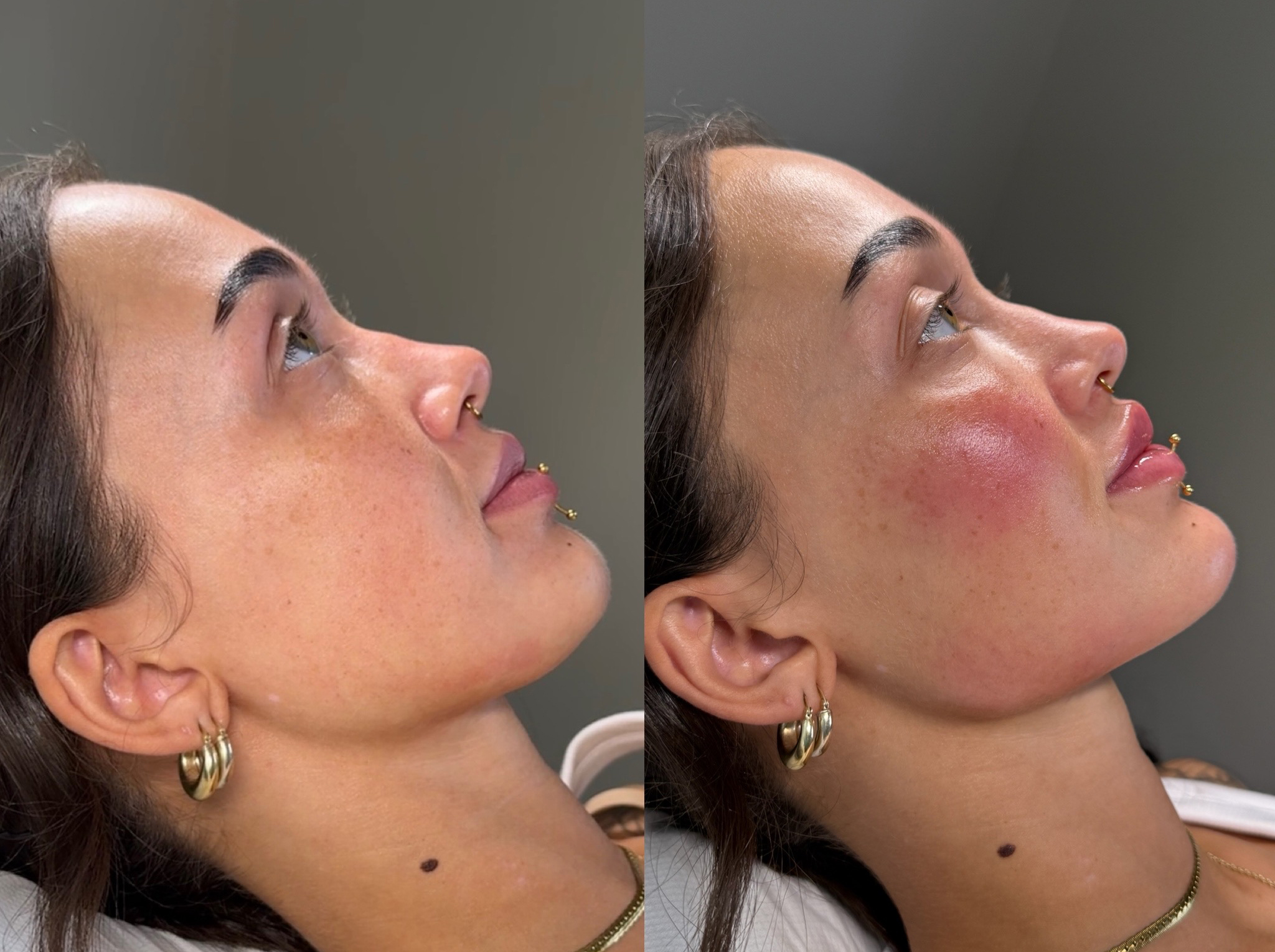 Profile Balancing