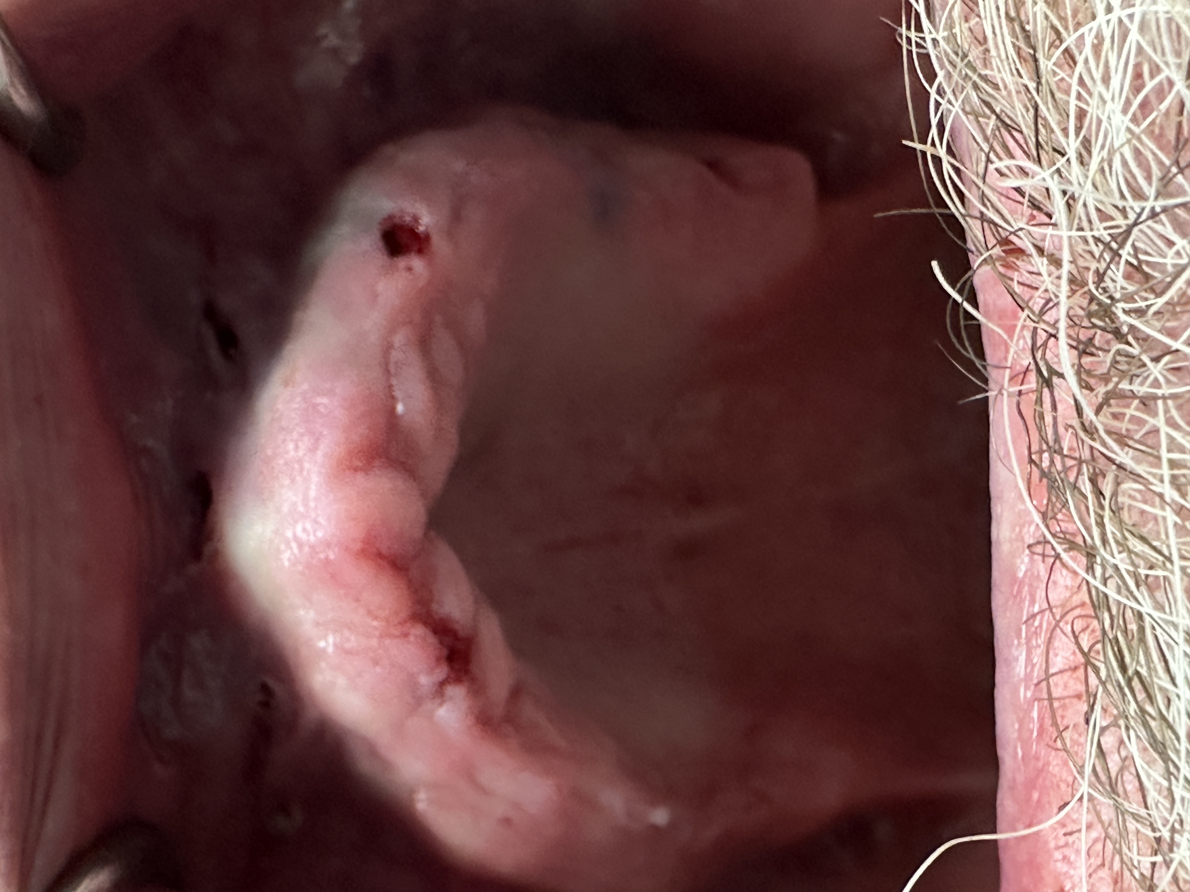 Robotic case after 3