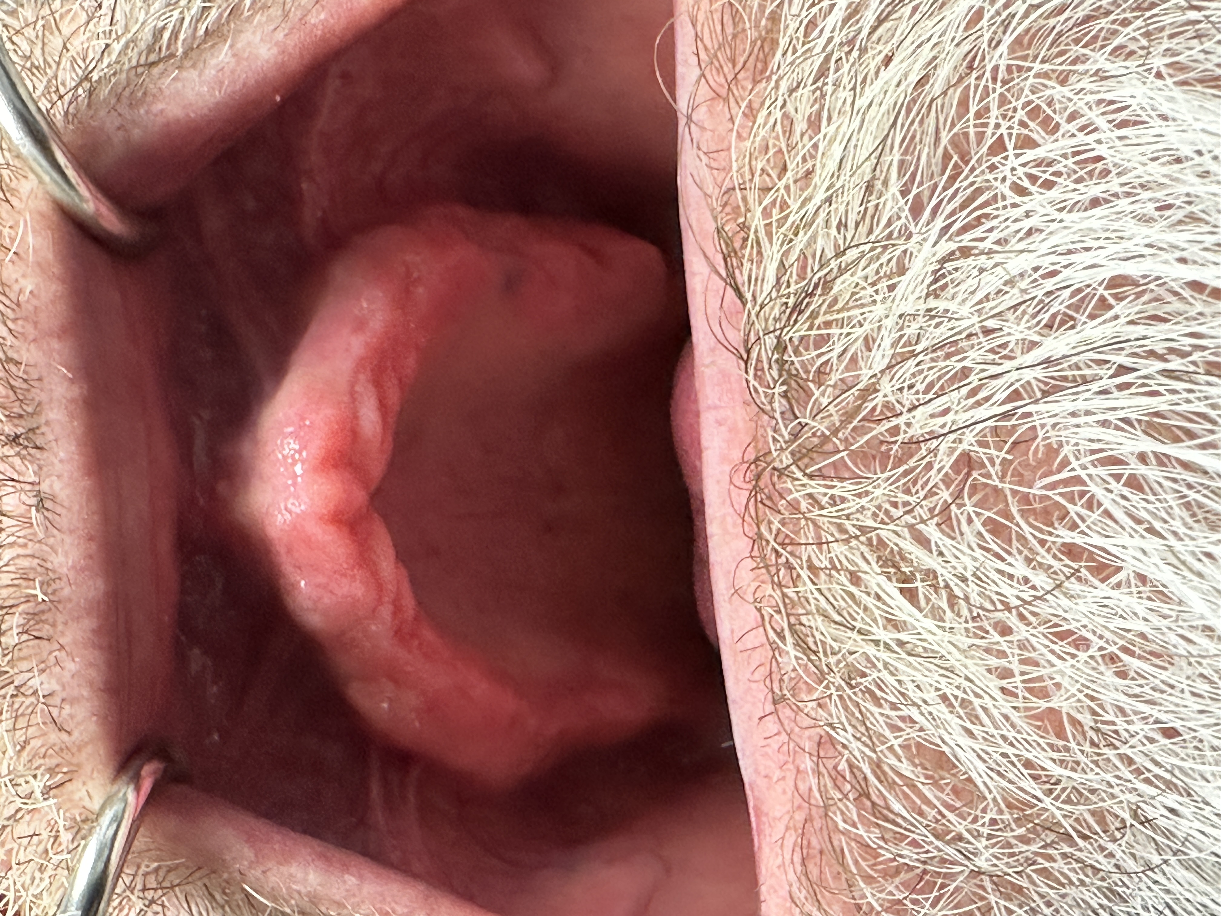 Robotic case before 3