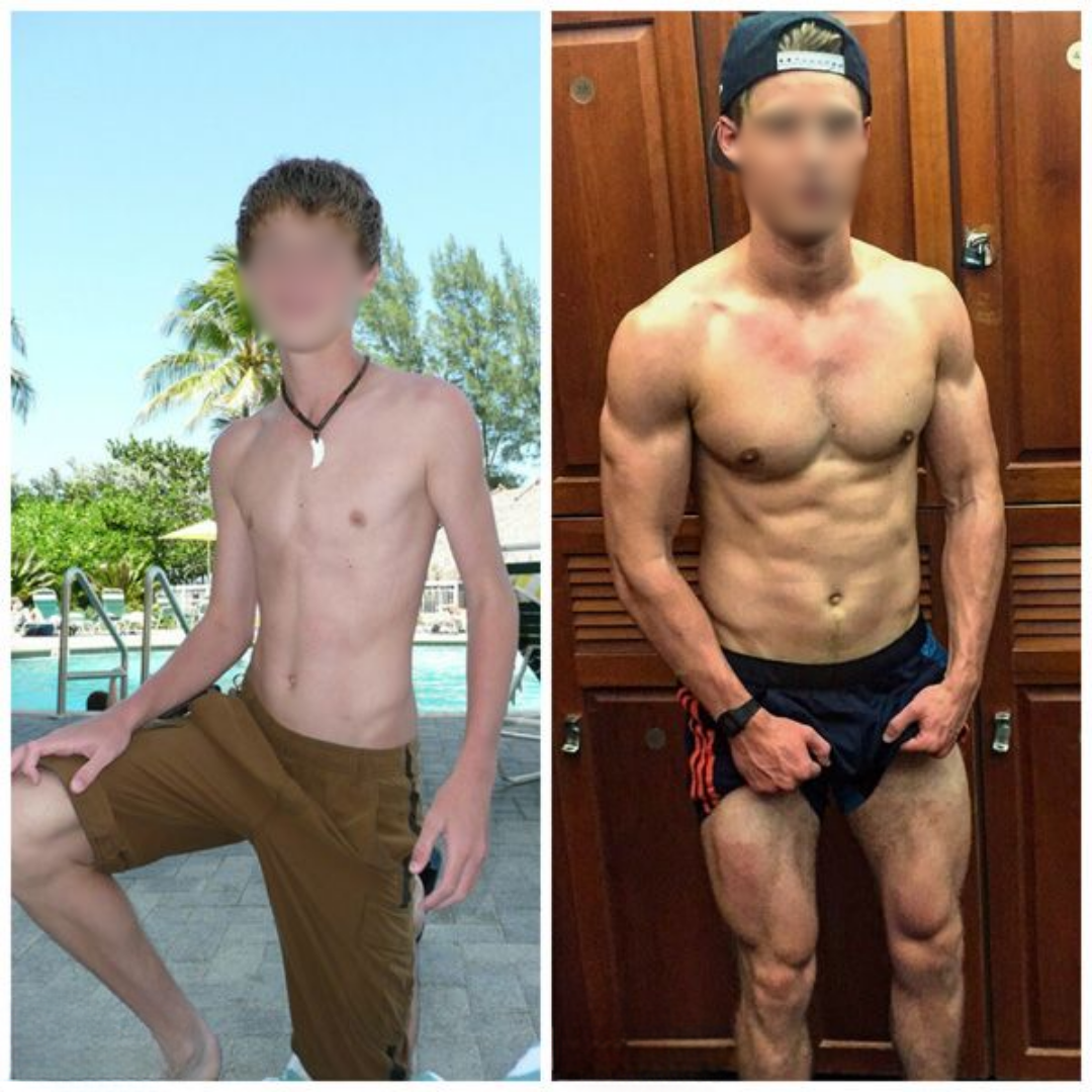 Gabriel, 21 anni, prima e dopo