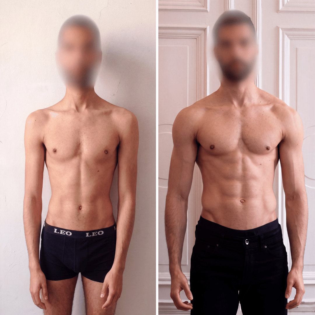 Manuel, 25 anni, prima e dopo