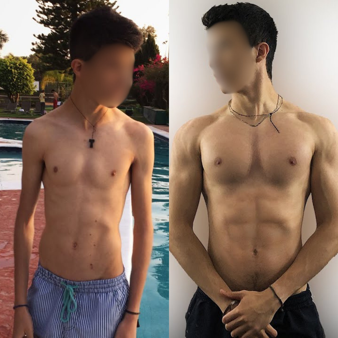 Marco, 21 anni, prima e dopo