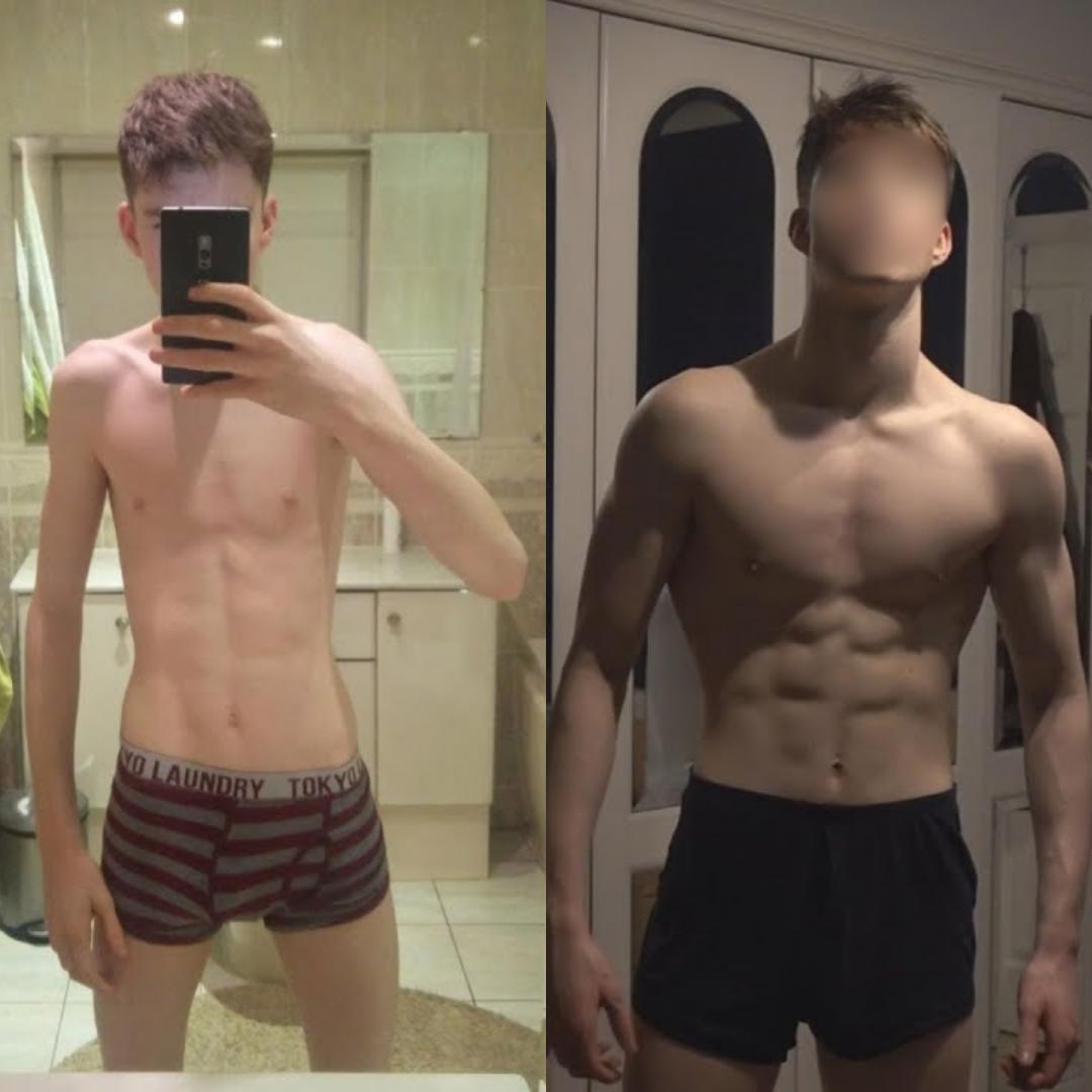 Edoardo, 19 anni, prima e dopo