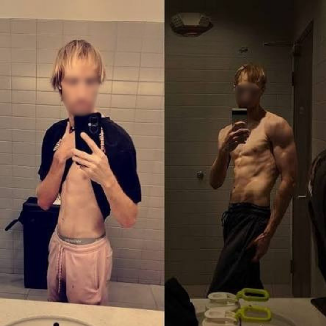 Alessio, 26 anni, prima e dopo