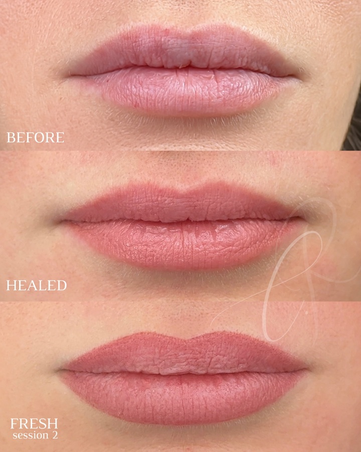 Sheer Sculpted Lips before, healed and fresh result
