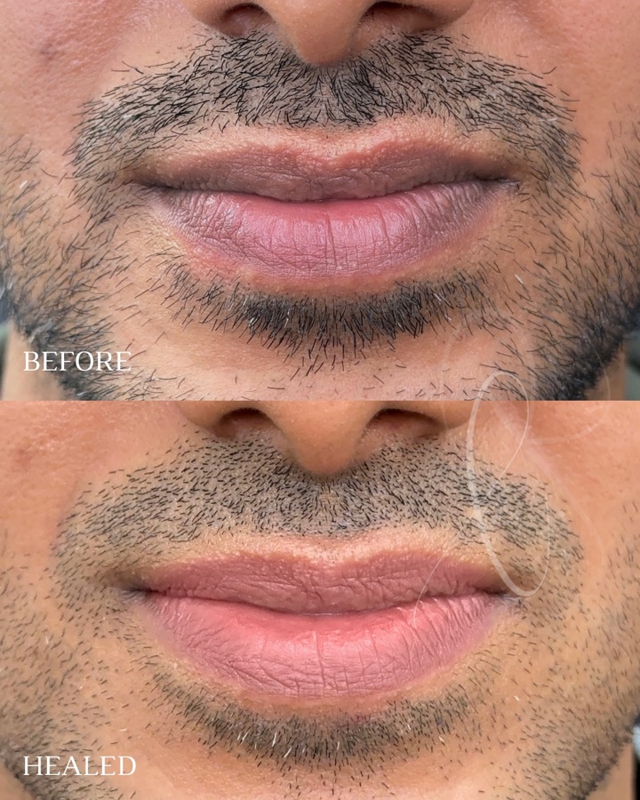 Natural masculine Sculpted Lips result