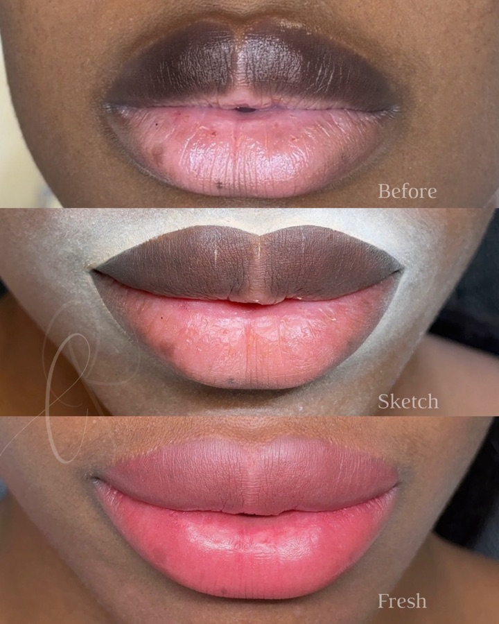 Defined Sculpted Lips treatment result