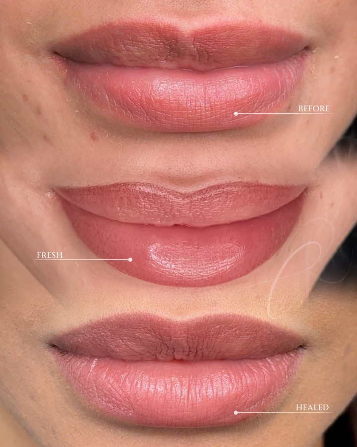 Bold Sculpted Lips fresh and healed result