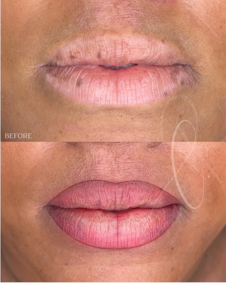 Dimensional Sculpted Lips result
