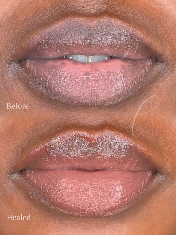 Masculine Sculpted Lips result
