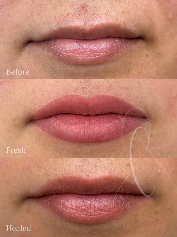 Mature Sculpted Lips result