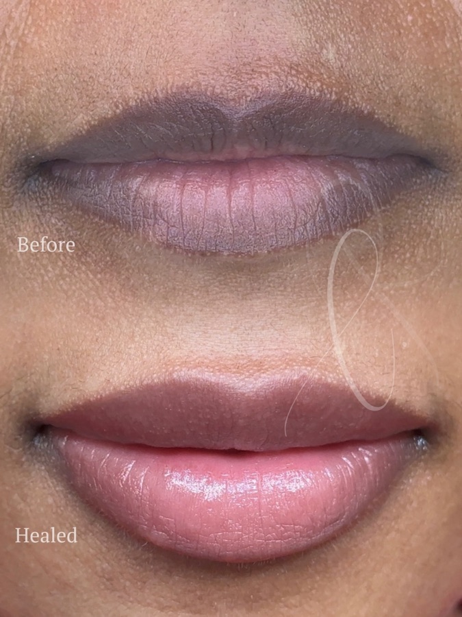 Dimensional Sculpted Lips result