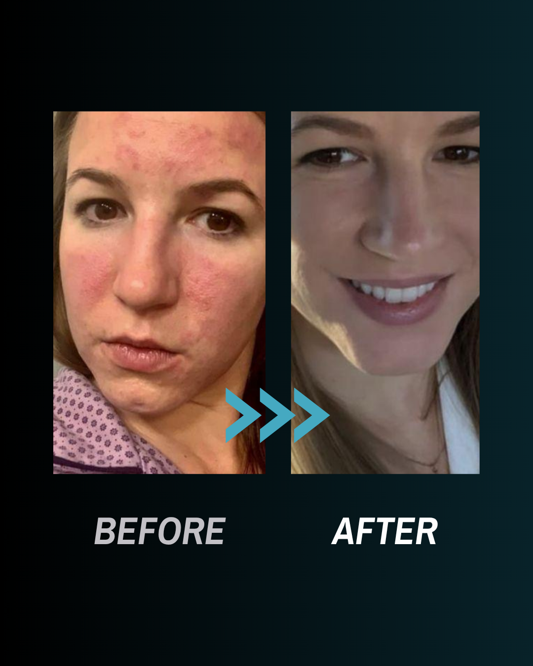 Transformation 4