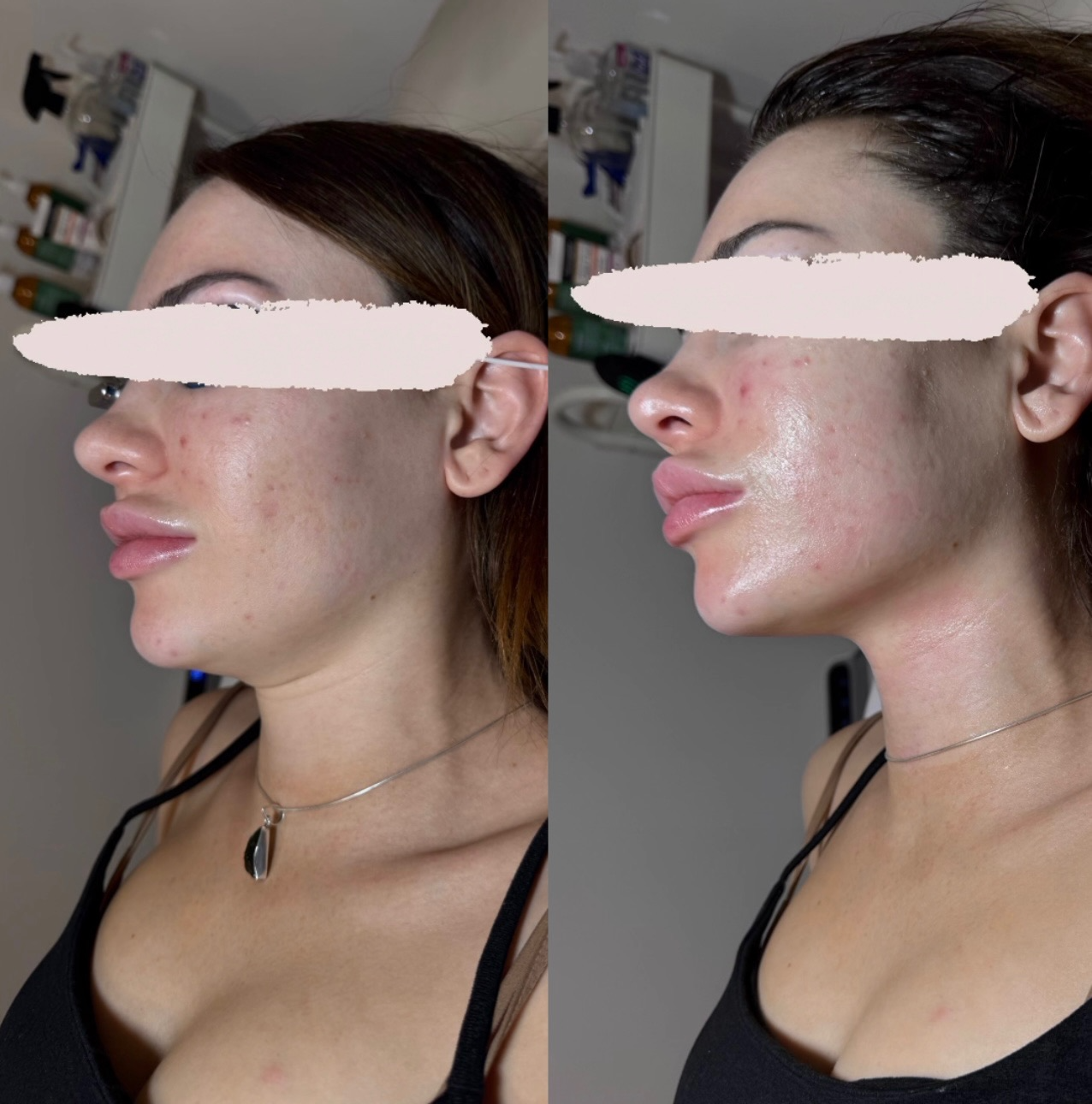 Before and After 3