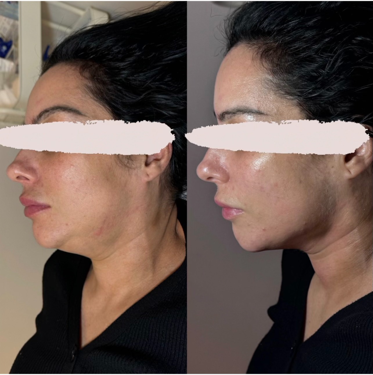 Before and After 2
