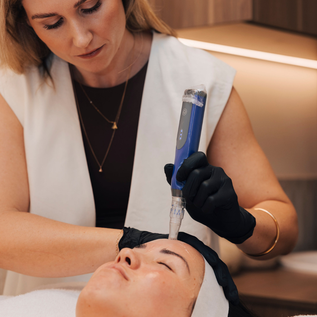 Skin Needling with Exosomes treatment at Pelle Clinic