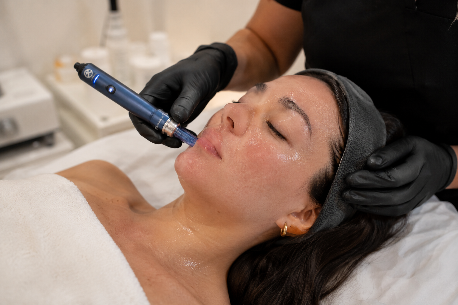 Microneedling at Aesthoria