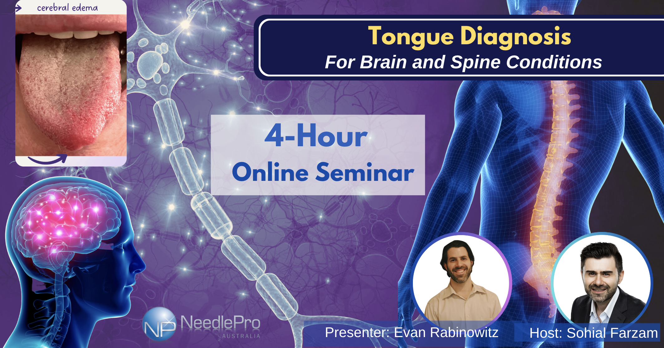 Tongue Diagnosis for Brain and Spine Conditions