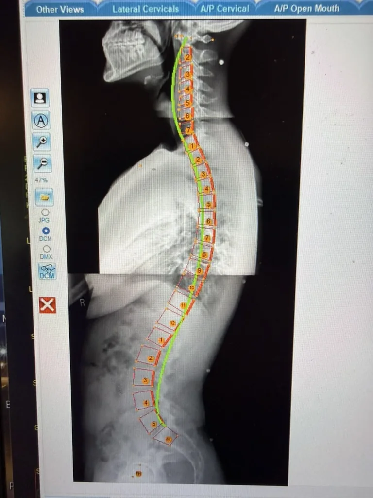 Dr. Austin Pollack examining a patient during a Gonstead chiropractic assessment