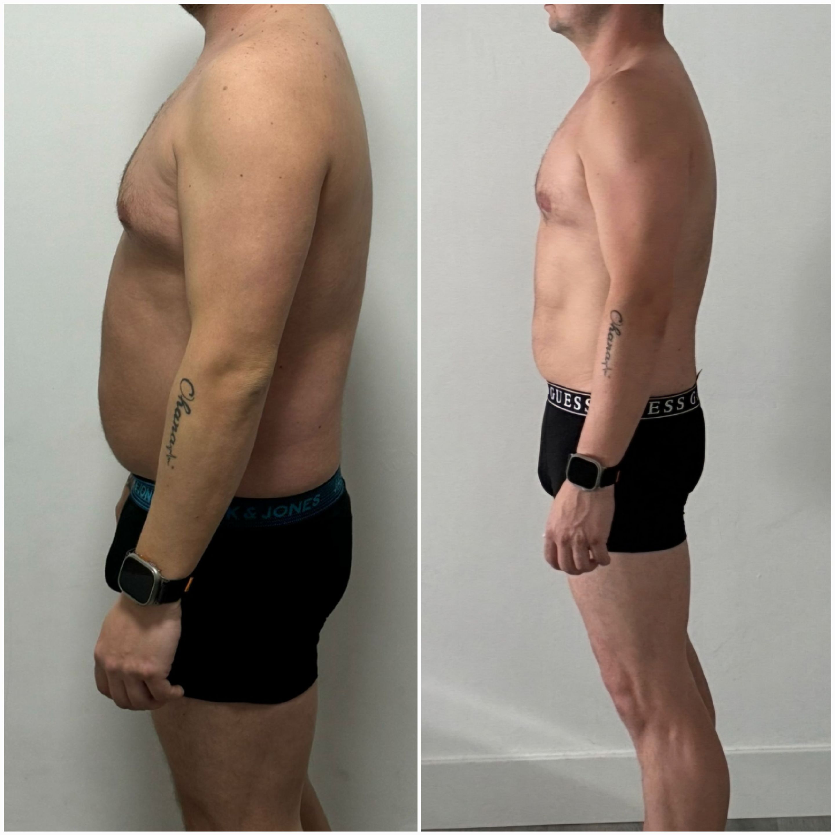 Transformación 11