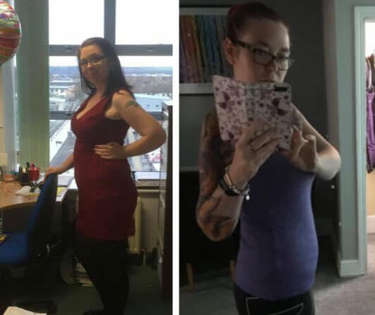 Anna transformation