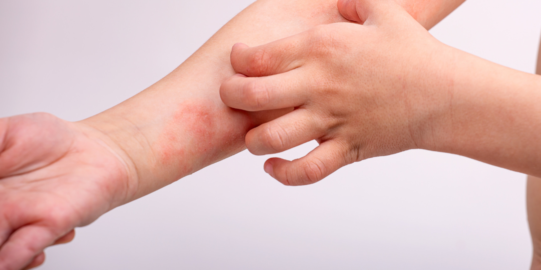 Dermatología pediátrica