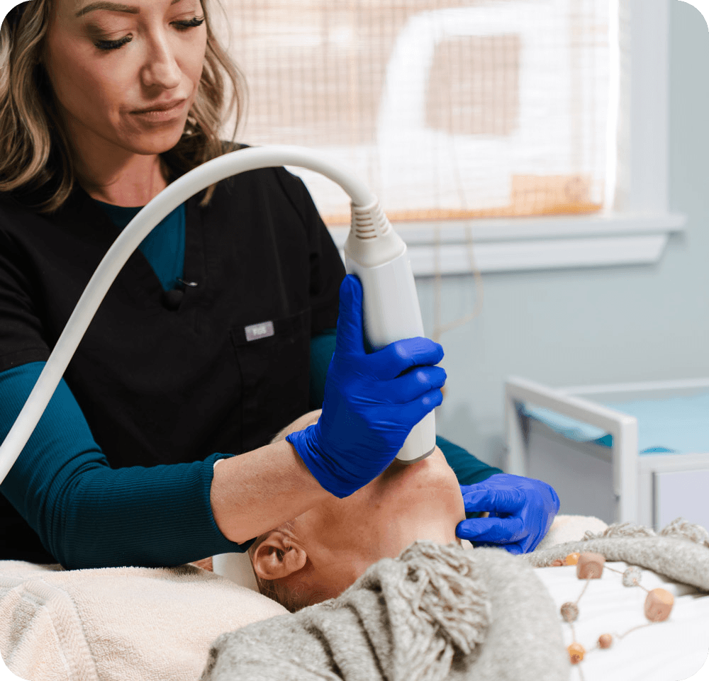 RF Microneedling
