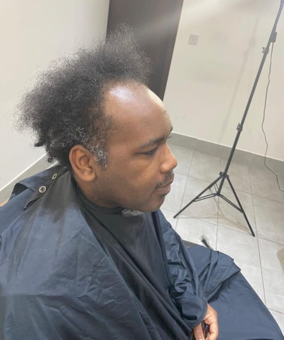 Client before