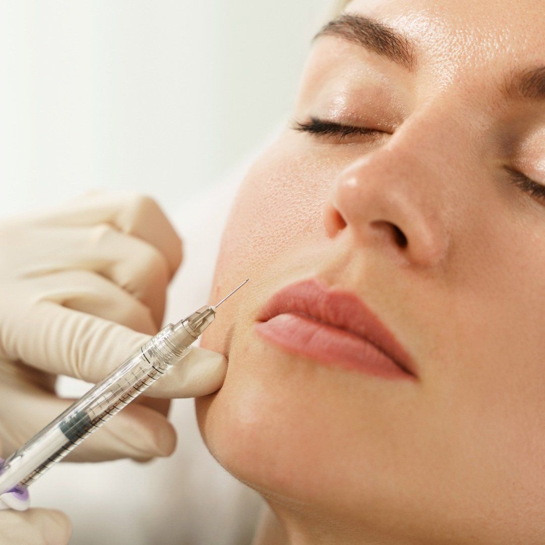 Dermal Fillers