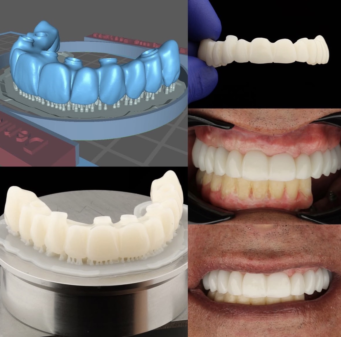 Diseño digital de sonrisa en clínica dental