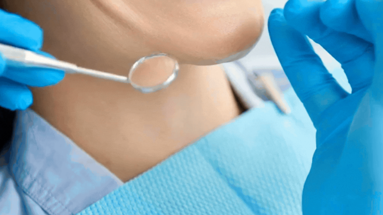 Estética Dental Corona Bucal