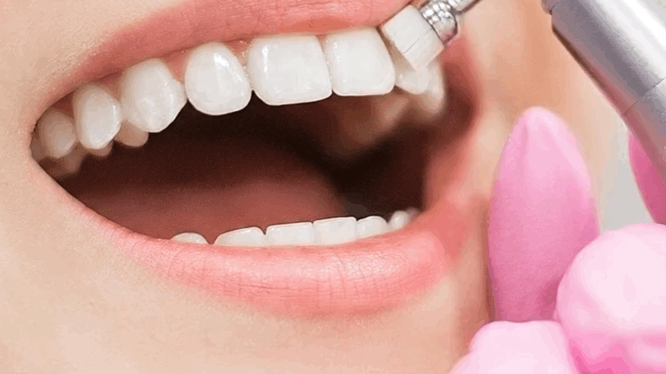 Odontología General Corona Bucal